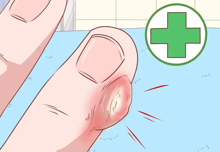 Gros plan d'un doigt enflammé avec une corne sur les mains, entouré d'un symbole médical vert.