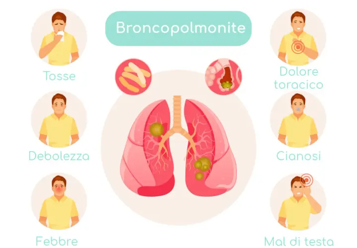 Illustrazione dei sintomi della broncopolmonite: tosse, debolezza, febbre, dolore toracico, cianosi e mal di testa.