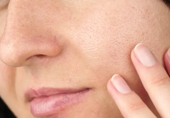 Gros plan sur une peau avec des pores visibles. Une main effleure la joue, suggérant une recherche de solutions pour comment enlever l'excès de sebum visage naturellement.