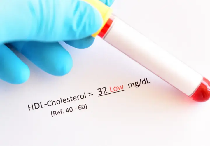 Wynik HDL-Cholesterolu to 32 mg/dL, co jest niskim wynikiem. Pamiętaj o zdrowym stylu życia, by utrzymać prawidłowy poziom **pitamet**.