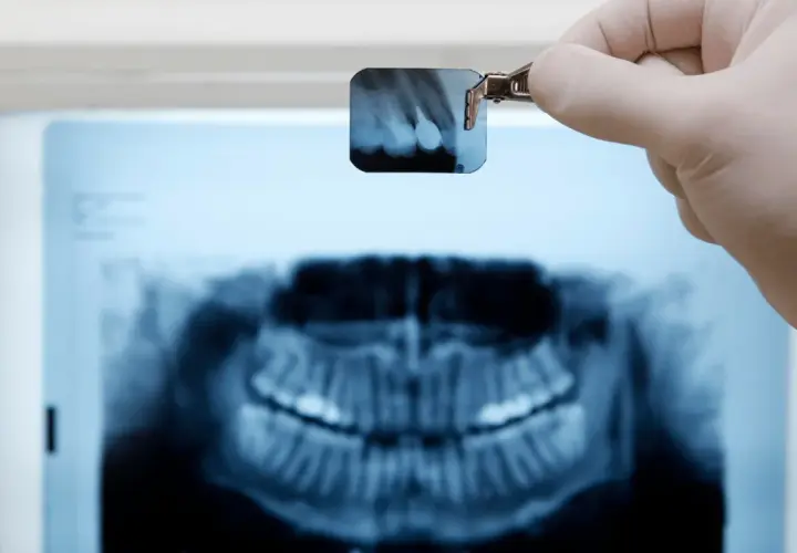 Rtg zęba jak odczytać? Dentysta trzyma małe zdjęcie RTG, analizując je na tle większego obrazu szczęki.