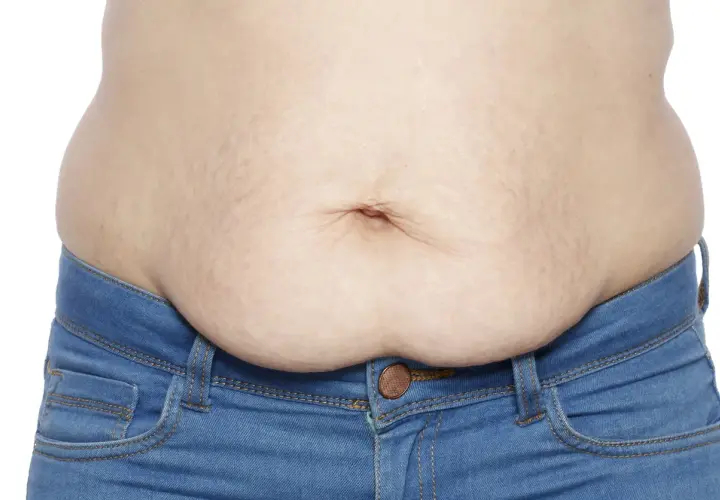 En mage med slapp hud efter viktnedgång, med synliga bristningar och en navel. Bär blå jeans.