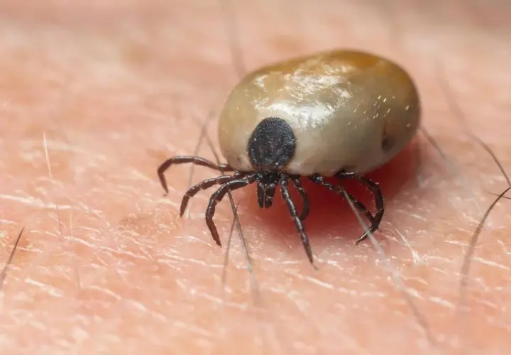 Una garrapata se aferra a la piel, un detalle que podría hacerte soñar con garrapatas.