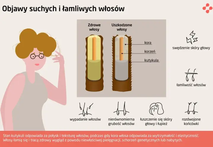 Ilustracja porównująca zdrowe i uszkodzone włosy, z ikonami objawów.