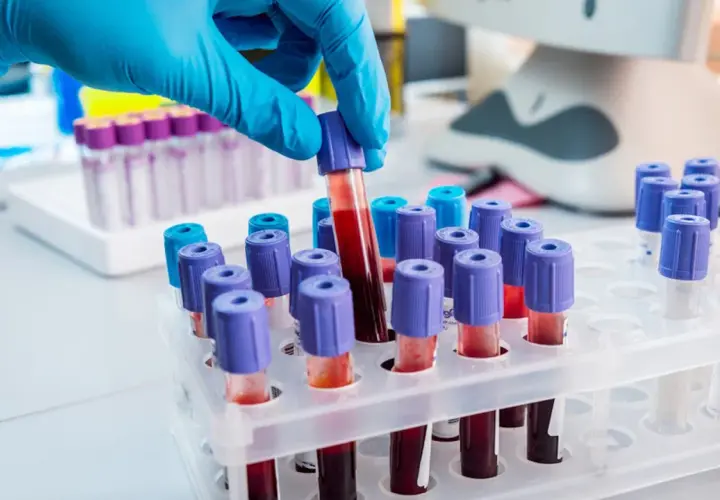 Ręka w niebieskiej rękawiczce pobiera probówkę z krwią. W tle stojaki z próbkami, sprzęt laboratoryjny. To ważny etap w badaniach arhd+.