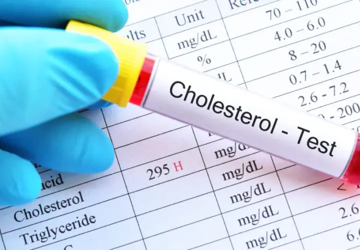 Jak stres podnosi cholesterol i co możesz z tym zrobić dla zdrowia