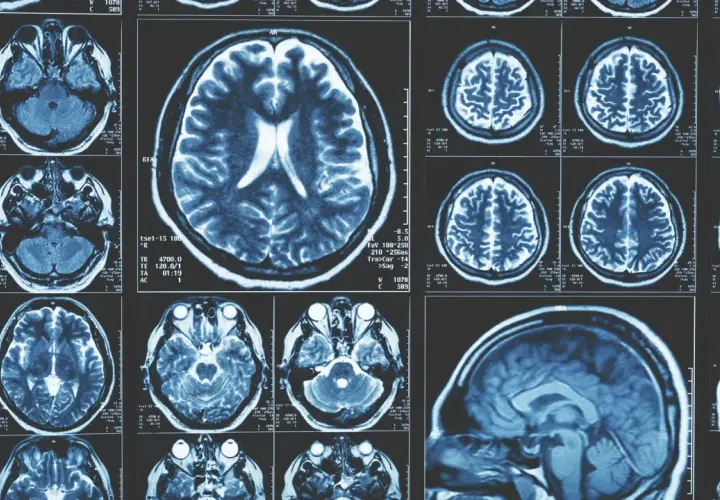 Imágenes de resonancia magnética cerebral. Cortes axiales y sagitales que muestran la estructura del cerebro, como si fuera una memoria fotogénica.