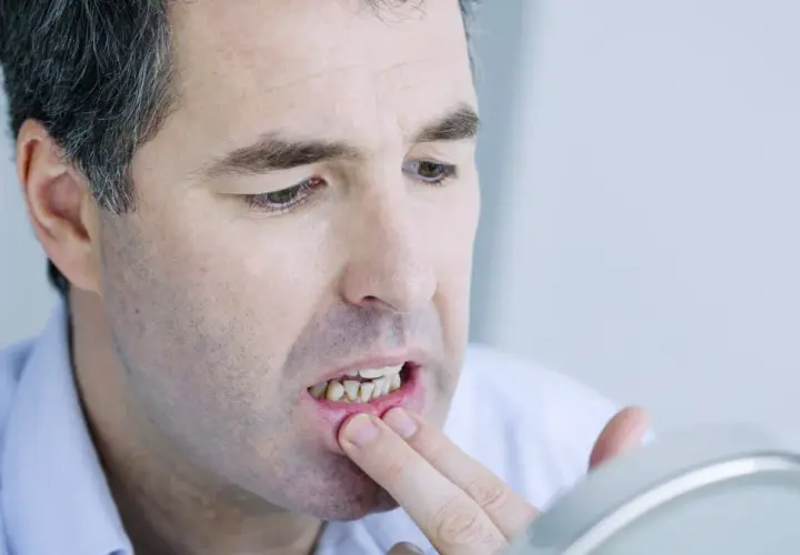 Ból dziąseł: Przyczyny, domowe sposoby i kiedy iść do dentysty