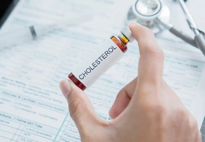 Dłoń trzyma fiolkę z napisem "CHOLESTEROL" na tle dokumentacji medycznej i stetoskopu. Czy tabletki na cholesterol trzeba brać do końca życia?