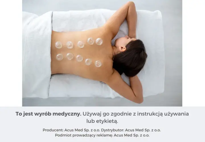 Kobieta z bańkami na plecach, stosowanymi jako metoda wspomagająca leczenie kaszlu.