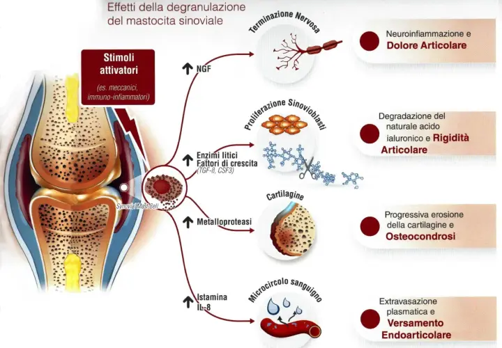 Il mastocita sinoviale, stimolato, rilascia mediatori che causano neuroinfiammazione, degradazione cartilaginea e dolore articolare. L'effetto del pea è da valutare in base alla patologia.
