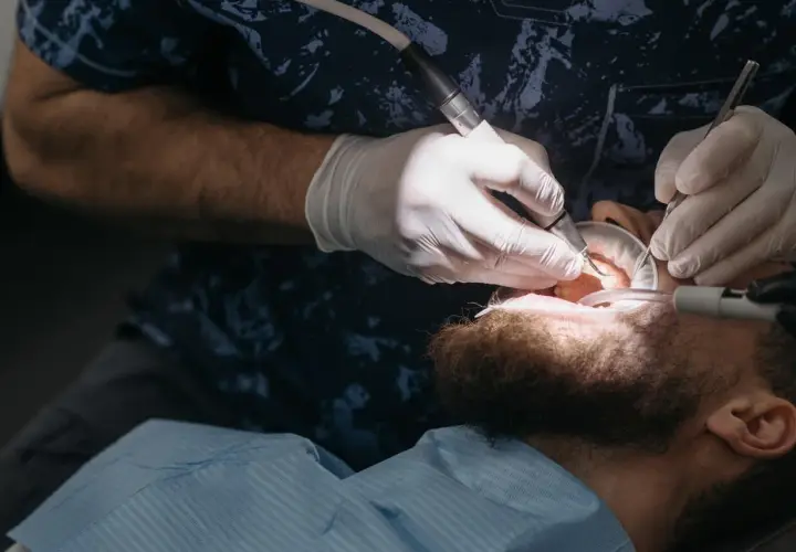 Dentysta w białych rękawiczkach używa wiertła i narzędzi, by oczyścić zęby pacjenta. To właśnie robi fleczer, co to za zabieg?
