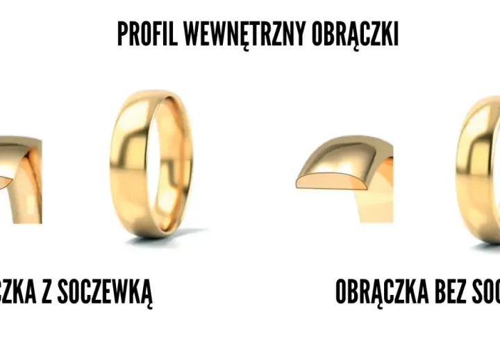 Obrączki z soczewką: co to znaczy i czy warto? Komfort na lata!