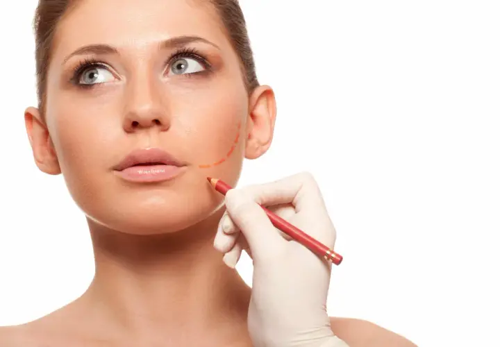 En hand i handske markerar ansiktet med en röd penna, förberedelse för buccal fat removal.