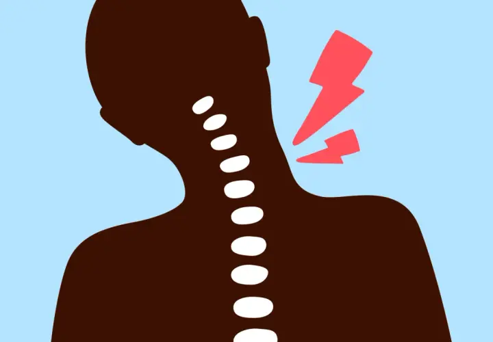 Silhouette d'une personne avec une colonne vertébrale visible, souffrant d'un torticolis sévère marqué par des éclairs rouges.