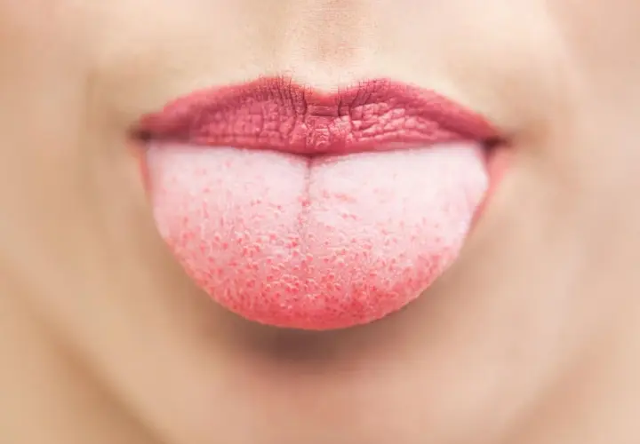 Lingua gonfia, segno di stress. La bocca è aperta, le labbra rosse e la lingua rosa sporge, mostrando la sua superficie ruvida.