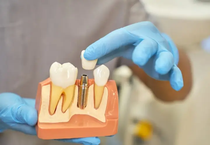 Jak dentysta sprawdza, który ząb boli i co musisz wiedzieć o bólu zębów