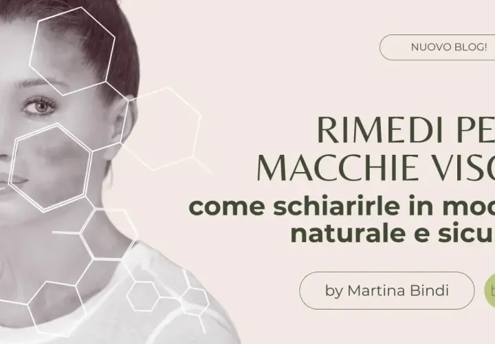 Donna con macchie sul viso, con grafiche esagonali. Titolo: "Rimedi per macchie viso: come coprire le macchie sul viso in modo naturale e sicuro".