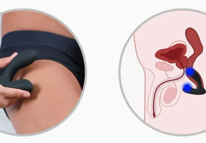 Dłoń trzymająca czarny masażer prostaty obok schematu męskiej anatomii z podświetloną prostatą.
