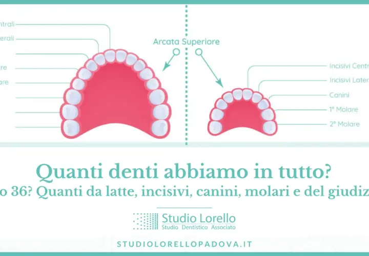 Illustrazione delle arcate dentali superiore e inferiore, con etichette che indicano incisivi, canini e molari. Quanti denti abbiamo?