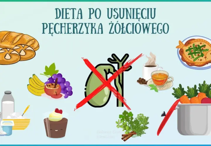 Ilustracja przedstawia produkty spożywcze, przekreślony pęcherzyk żółciowy i garnek z warzywami.