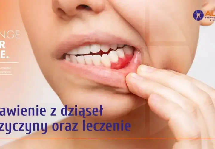 Krwotok z dziąsła? Zatamuj go natychmiast! Przyczyny i porady