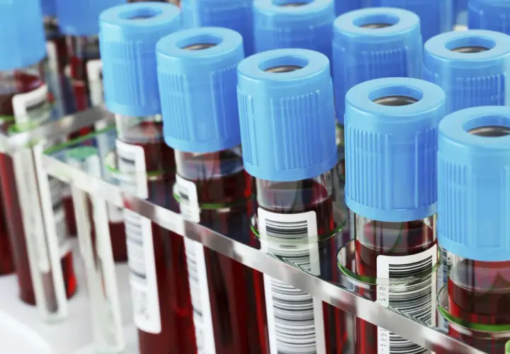Rząd probówek z krwią, każda z niebieską zakrętką. W tle widać więcej probówek, tworząc laboratoryjny prf.