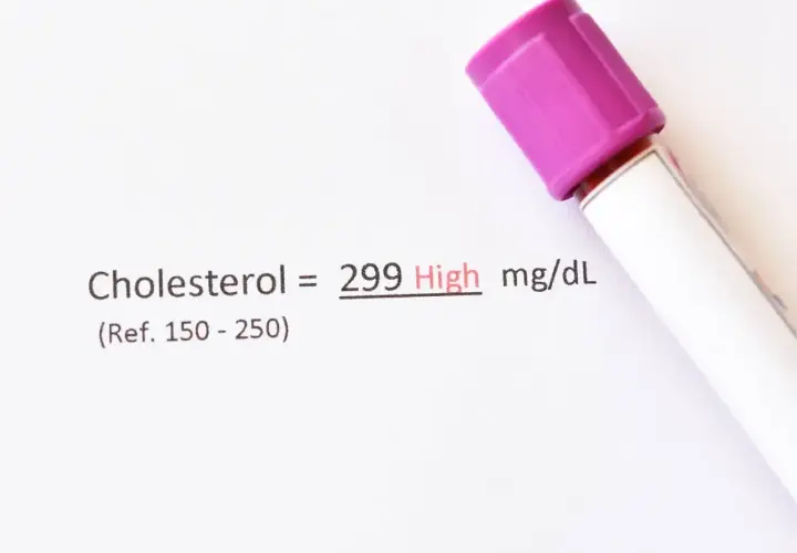 Wynik cholesterolu 299 mg/dL, co jest wysokim poziomem. Wskazuje to na potrzebę konsultacji z lekarzem, aby omówić ewentualne zmiany w stylu życia lub leczenie.
