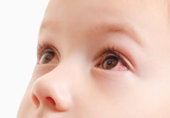 Occhio di neonato con una piccola macchia rossa, forse un segno di stanchezza o irritazione.