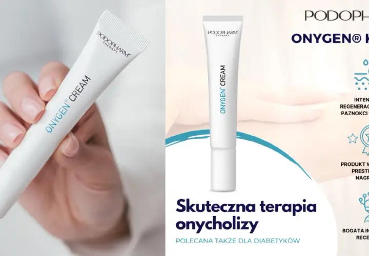 Krem ONYGEN® do intensywnej regeneracji paznokci dłoni i stóp. Skuteczna terapia onycholizy, polecana także dla diabetyków.