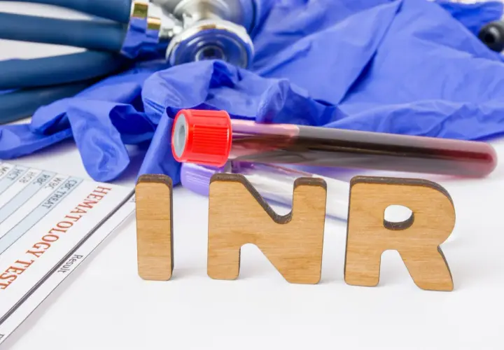 Drewniane litery INR na tle rękawiczek medycznych, stetoskopu i probówek z krwią. Wyniki badań hematologicznych.
