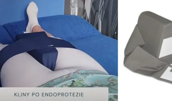 Czy po endoprotezie biodra przysługuje renta? Sprawdź warunki i pomoc