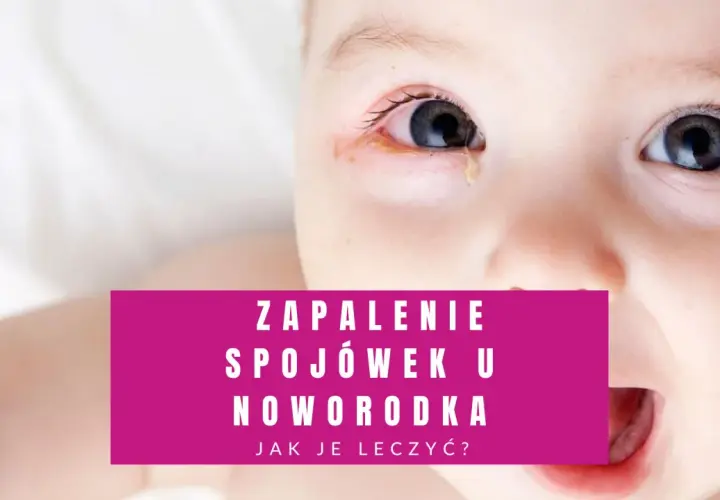 Zbliżenie na twarz noworodka z widocznymi zaczerwienionymi powiekami i łzawieniem. Tekst informuje o zapaleniu spojówek u noworodka.
