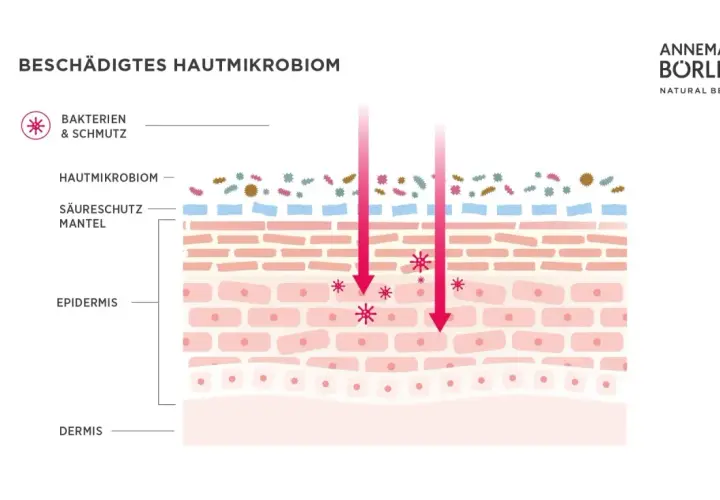 Schädigtes Hautmikrobiom: Bakterien und Schmutz dringen ein. Eine gesunde Hautbarriere ist die Wunderwaffe für ein gesundes Hautmikrobiom.
