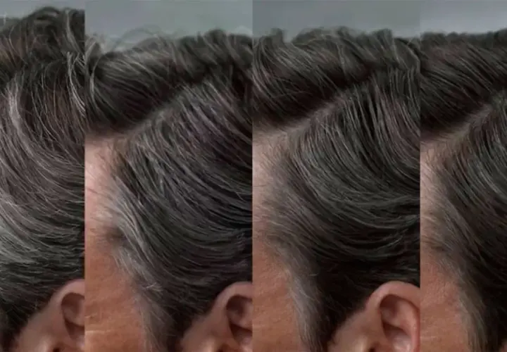 El pelo blanco de un hombre se transforma en oscuro.