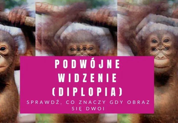 Małpka z potrójnymi oczami, jakby miała podwójne widzenie. Sprawdź, co to znaczy, gdy obraz się dwoi.