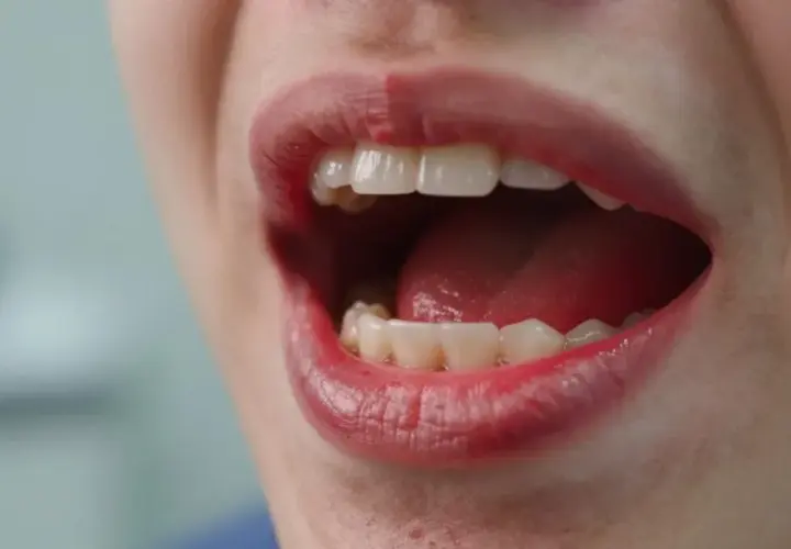 Podrażnione dziąsła? Sprawdzone sposoby i kiedy iść do dentysty