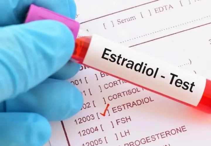 Ręka w niebieskiej rękawiczce trzyma probówkę z napisem "Estradiol - Test". Obok widoczna lista badań, gdzie zaznaczono "ESTRADIOL".