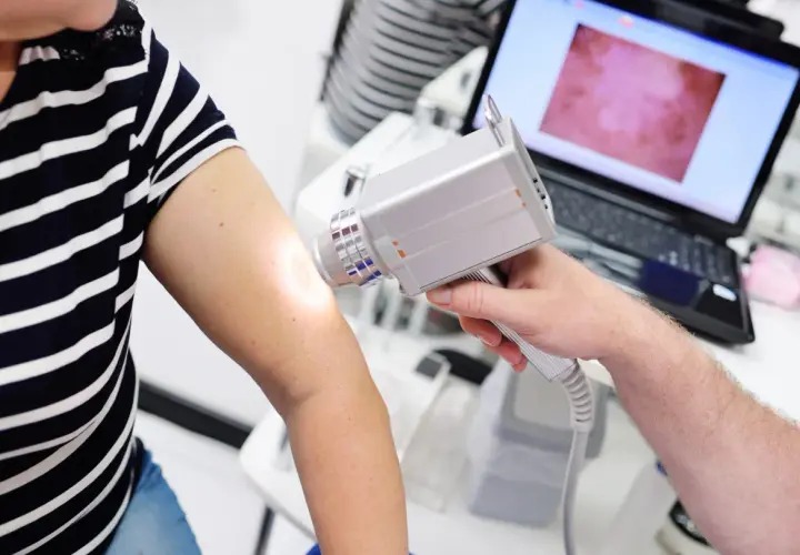 Dermatoskopia co to? Lekarz bada znamiona na ramieniu pacjentki za pomocą dermatoskopu, obraz widoczny na ekranie laptopa.