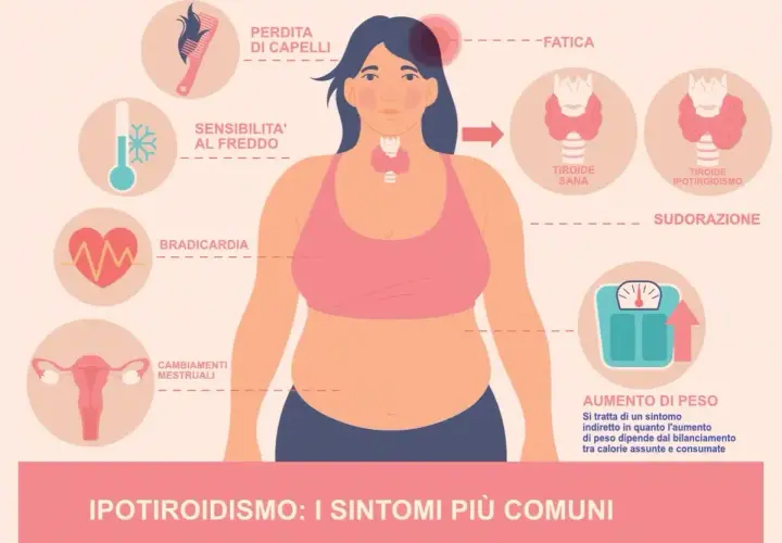 Ipotiridismo: sintomi come perdita capelli, stanchezza, aumento peso e ansia. La tiroide ipotiroidea causa questi disturbi.