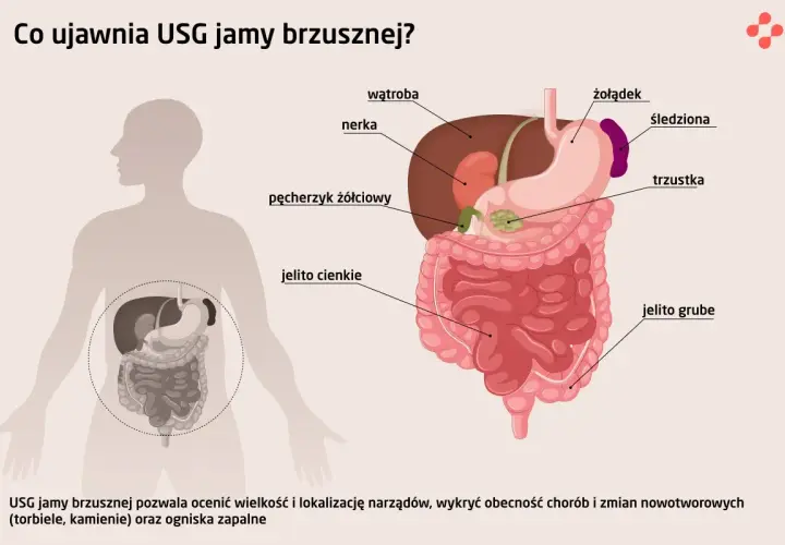 USG jamy brzusznej co wykrywa: wątrobę, nerki, żołądek, jelita, trzustkę, pęcherzyk żółciowy. Pomaga wykryć torbiele, kamienie i zapalenia.