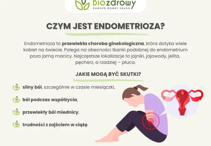 Endometrioza: Jakie leki? Skutki, płodność i nowe terapie w PL