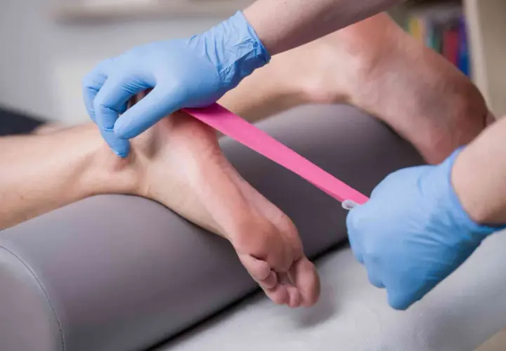 Fizjoterapeuta zakłada taśmę kinezjotaping na stopę, wspierając ćwiczenia na ostrogę piętową.