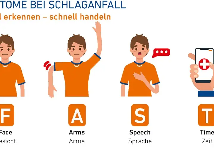 Apoplexie Symptome: Erkennen Sie die alarmierenden Anzeichen sofort