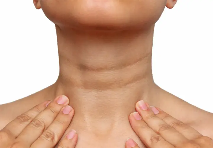 Cuello con acantosis nigricans, mostrando la hiperpigmentación y textura irregular. Se exploran opciones de tratamiento.