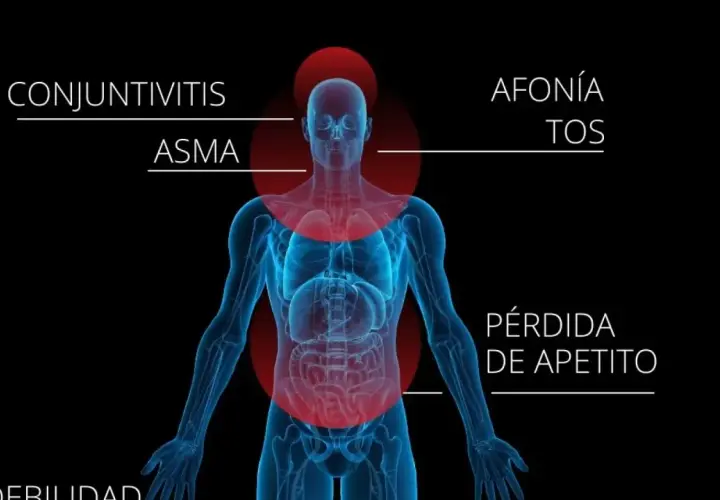 Ilustración de un cuerpo humano con zonas rojas indicando síntomas como conjuntivitis, asma, afonía, tos y pérdida de apetito, posiblemente por polen flor.