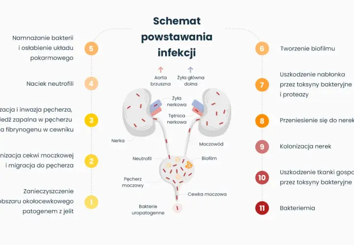 Schemat powstawania infekcji dróg moczowych, wyjaśniający, czy zapalenie pęcherza jest zaraźliwe. Pokazuje drogę bakterii od jelit do nerek.