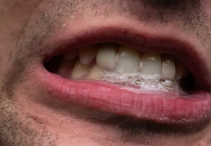 Bocca con schiuma e denti visibili. La salivazione eccessiva può essere un sintomo di ansia.