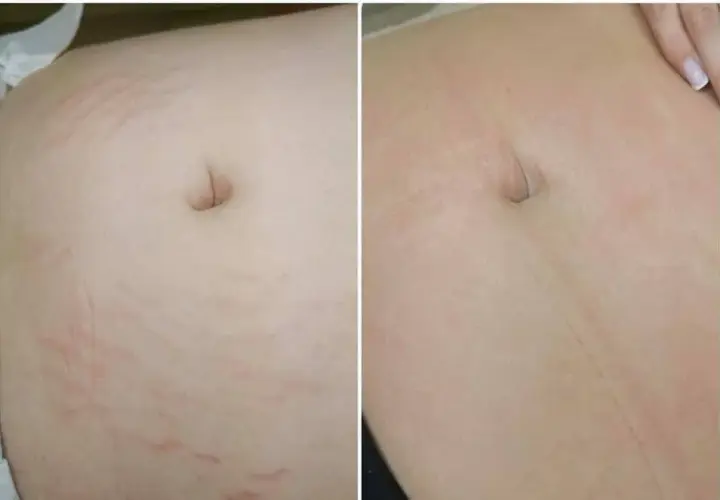 Gdzie kupić deep phyto peeling i uniknąć nieefektywnych produktów