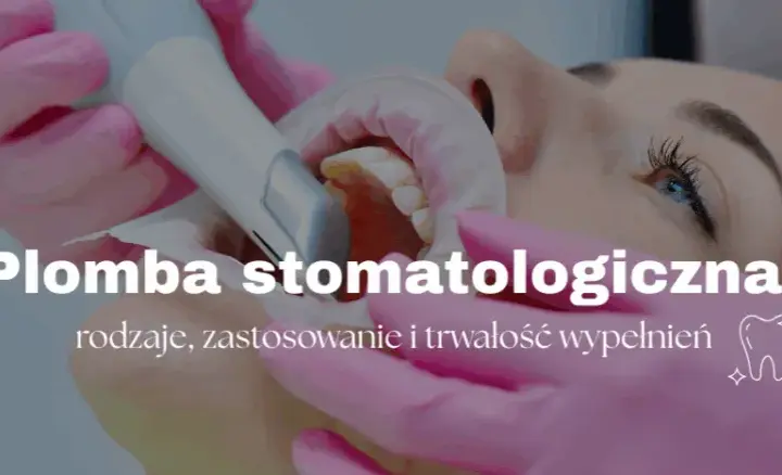 Plombowanie zęba: Ile to potrwa? Czas, etapy i komfort wizyty